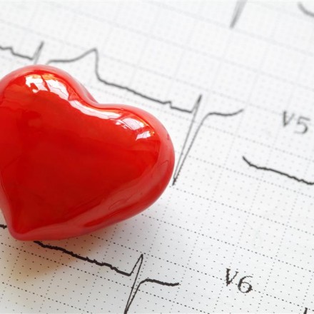 Echocardiogram